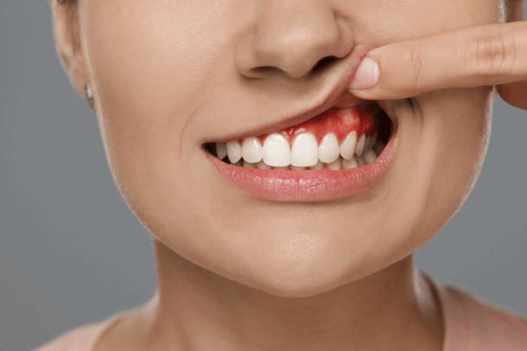 Woman with gum disease