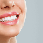 Woman with dental veneers