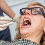 Woman in dentist chair behing checked for a cavity